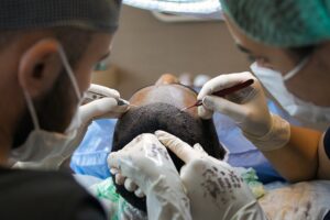 A man undergoing a hair transplant surgery