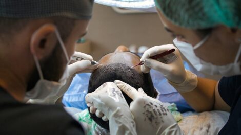 A man undergoing a hair transplant surgery